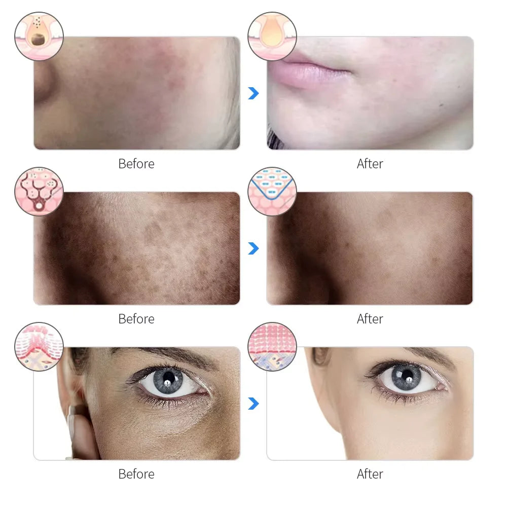Rechargeable Facial 7 color LED Mask